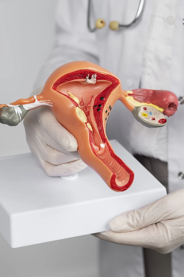 adenomiosis dificulta embarazo