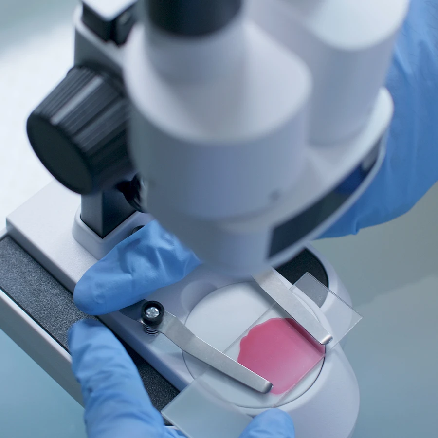 Inseminacion artificial