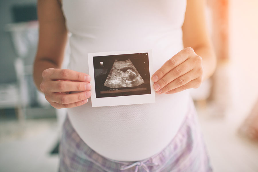 ¿Cuántas ecografías se recomiendan hacer durante el embarazo?